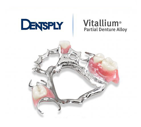 How long do removable dentures last?